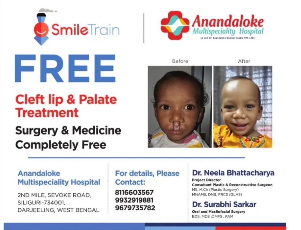Free Cleft Lip & Palate Treatment at Anandaloke Multispeciality Hospital, Siliguri